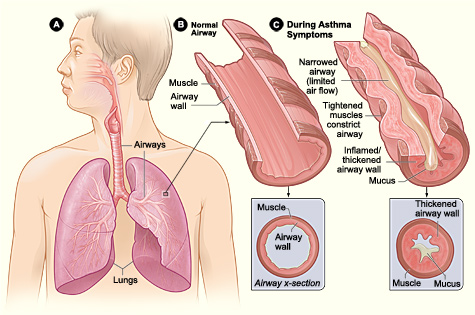 Chest problems