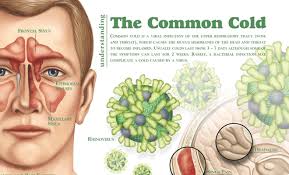 commoncold