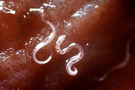 roundworms