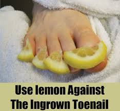 lemontonsil